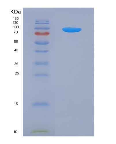 SDS-PAGE analysis of Human APP (Amyloid-Beta Precursor Protein) - Recombinant Protein, showing >90% purity under 15% SDS-PAGE (Reduced)