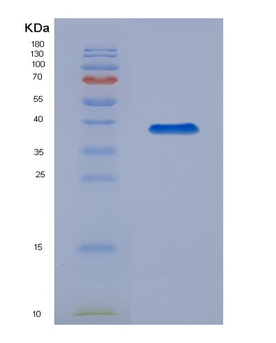 SDS-PAGE analysis of Mouse Mmp8 (Neutrophil Collagenase) - Recombinant Protein, showing >90% purity under 15% SDS-PAGE (Reduced)