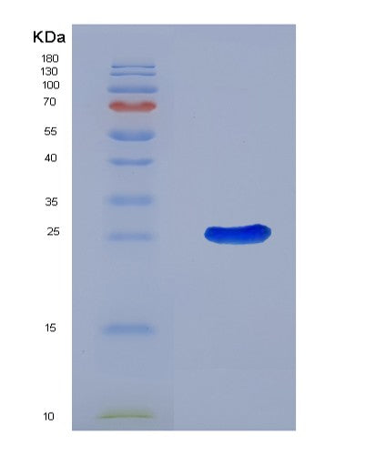 SDS-PAGE analysis of Mouse Adora2a (Adenosine Receptor A2A) - Recombinant Protein, showing >90% purity under 15% SDS-PAGE (Reduced)