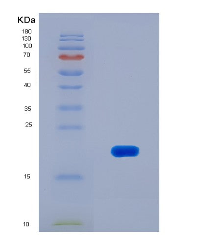 SDS-PAGE analysis of Human MAP3K7CL (Map3K7 C-Terminal-Like Protein) - Recombinant Protein, showing >90% purity under 15% SDS-PAGE (Reduced)