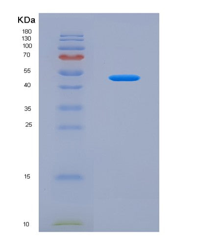 SDS-PAGE analysis of Human SEMA6D (Semaphorin-6D) - Recombinant Protein, showing >90% purity under 15% SDS-PAGE (Reduced)