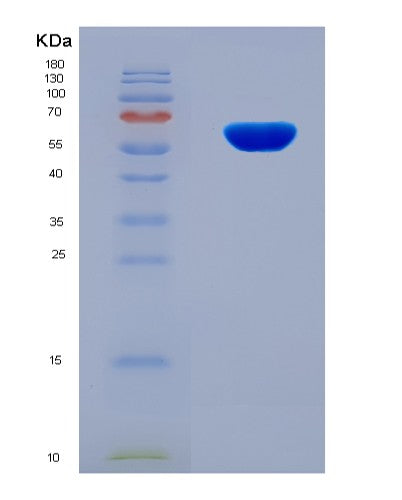 SDS-PAGE analysis of Human CDK13 (Cyclin-Dependent Kinase 13) - Recombinant Protein, showing >90% purity under 15% SDS-PAGE (Reduced)