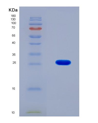 SDS-PAGE analysis of Human CTH (Cystathionine Gamma-Lyase) - Recombinant Protein, showing >90% purity under 15% SDS-PAGE (Reduced)