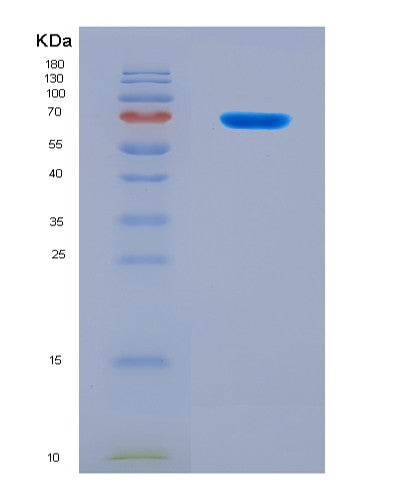 SDS-PAGE analysis of Human DNER (Delta And Notch-Like Epidermal Growth Factor-Related Receptor) - Recombinant Protein, showing >90% purity under 15% SDS-PAGE (Reduced)