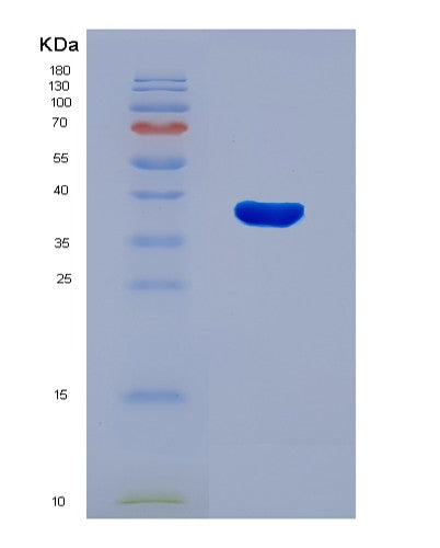 SDS-PAGE analysis of Human MTHFD2 (Bifunctional Methylenetetrahydrofolate Dehydrogenase/Cyclohydrolase, Mitochondrial) - Recombinant Protein, showing >90% purity under 15% SDS-PAGE (Reduced)