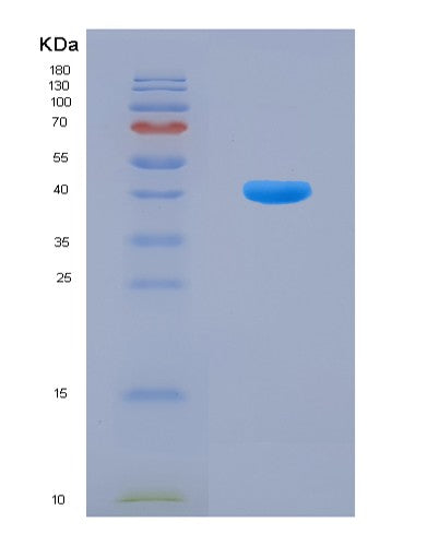 SDS-PAGE analysis of Human OCLN (Occludin) - Recombinant Protein, showing >90% purity under 15% SDS-PAGE (Reduced)