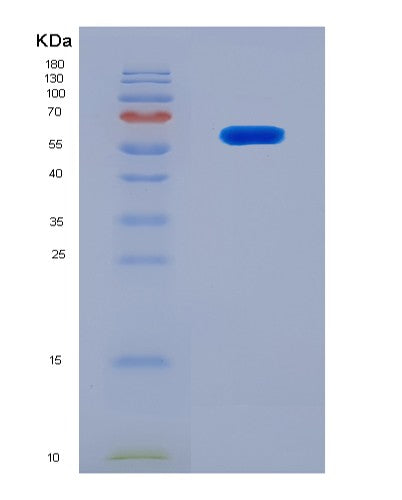 SDS-PAGE analysis of Mouse Nrbf2 (Nuclear Receptor-Binding Factor 2) - Recombinant Protein, showing >90% purity under 15% SDS-PAGE (Reduced)