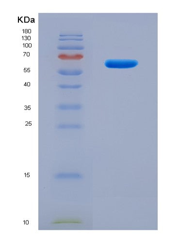 SDS-PAGE analysis of Human SQSTM1 (Sequestosome-1) - Recombinant Protein, showing >90% purity under 15% SDS-PAGE (Reduced)