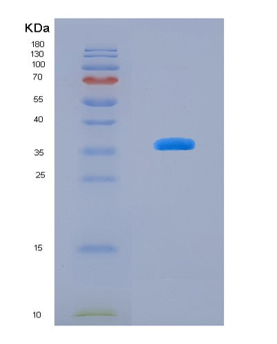 SDS-PAGE analysis of Human GBP4 (Guanylate-Binding Protein 4) - Recombinant Protein, showing >90% purity under 15% SDS-PAGE (Reduced)