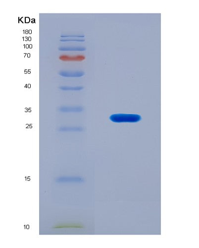 SDS-PAGE analysis of Mouse Hat1 (Histone Acetyltransferase Type B Catalytic Subunit) - Recombinant Protein, showing >90% purity under 15% SDS-PAGE (Reduced)