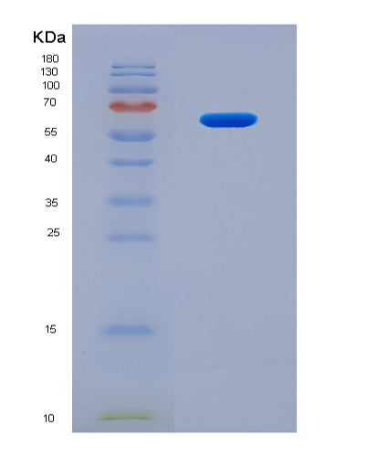 SDS-PAGE analysis of Mouse Hrg (Histidine-Rich Glycoprotein) - Recombinant Protein, showing >90% purity under 15% SDS-PAGE (Reduced)