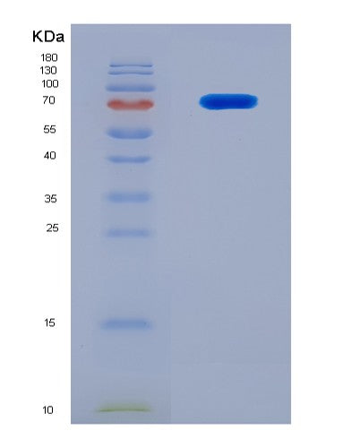 SDS-PAGE analysis of Human FOXO1 (Forkhead Box Protein O1) - Recombinant Protein, showing >90% purity under 15% SDS-PAGE (Reduced)