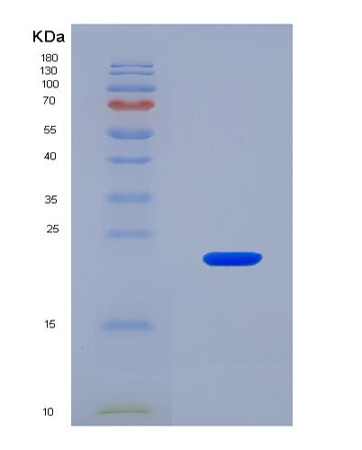 SDS-PAGE analysis of Mouse Lama4 (Laminin Subunit Alpha-4) - Recombinant Protein, CAT# BLT-08506P showing >90% purity under 15% SDS-PAGE (Reduced)