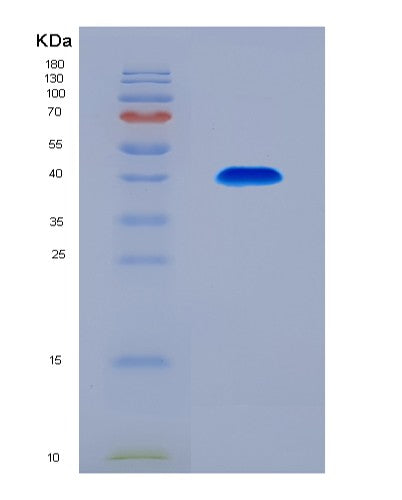 SDS-PAGE analysis of Human ACOT8 (Acyl-Coenzyme A Thioesterase 8) - Recombinant Protein, CAT# BLT-08513P showing >90% purity under 15% SDS-PAGE (Reduced)
