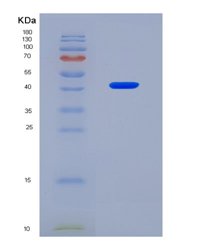 SDS-PAGE analysis of Human TFPT (Tcf3 Fusion Partner) - Recombinant Protein, CAT# BLT-08528P showing >90% purity under 15% SDS-PAGE (Reduced)