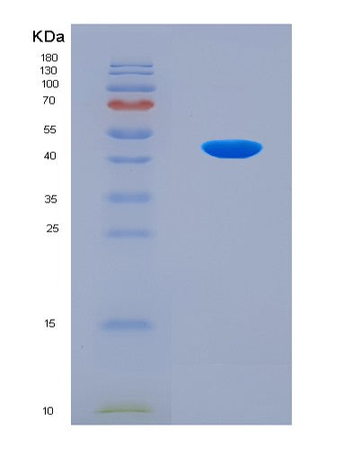 SDS-PAGE analysis of Human DMKN (Dermokine) - Recombinant Protein, CAT# BLT-08571P showing >90% purity under 15% SDS-PAGE (Reduced)