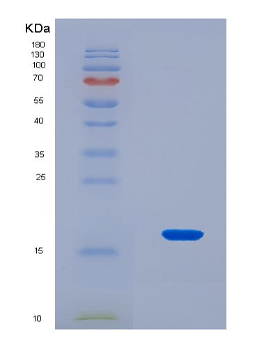 SDS-PAGE analysis of Human FIS1 (Mitochondrial Fission 1 Protein) - Recombinant Protein, CAT# BLT-08576P showing >90% purity under 15% SDS-PAGE (Reduced)
