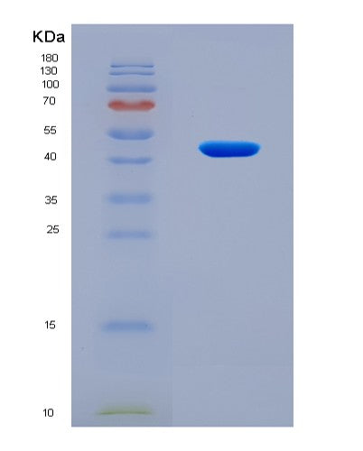 SDS-PAGE analysis of Human ZBP1 (Z-Dna-Binding Protein 1) - Recombinant Protein, CAT# BLT-08635P showing >90% purity under 15% SDS-PAGE (Reduced)