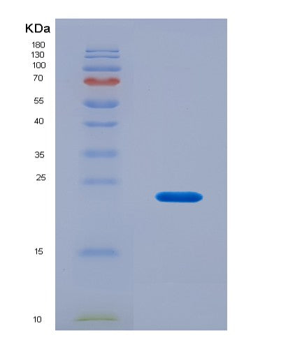 SDS-PAGE analysis of Human ITGB8 (Integrin Beta-8) - Recombinant Protein, CAT# BLT-08647P showing >90% purity under 15% SDS-PAGE (Reduced)