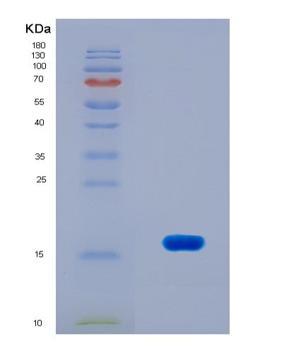 SDS-PAGE analysis of Mouse Nmu (Neuromedin-U) - Recombinant Protein, CAT# BLT-08658P showing >90% purity under 15% SDS-PAGE (Reduced)
