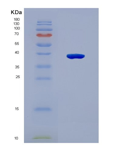 SDS-PAGE analysis of Human GBP5 (Guanylate-Binding Protein 5) - Recombinant Protein, CAT# BLT-08747P showing >90% purity under 15% SDS-PAGE (Reduced)