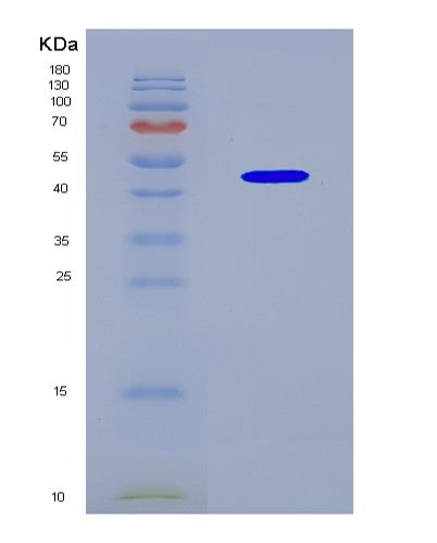 SDS-PAGE analysis of Human KCTD9 (Btb/Poz Domain-Containing Protein Kctd9) - Recombinant Protein, CAT# BLT-08766P showing >90% purity under 15% SDS-PAGE (Reduced)