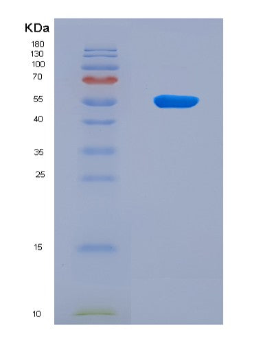 SDS-PAGE analysis of Human NADK (Nad Kinase) - Recombinant Protein, CAT# BLT-08798P showing >90% purity under 15% SDS-PAGE (Reduced)