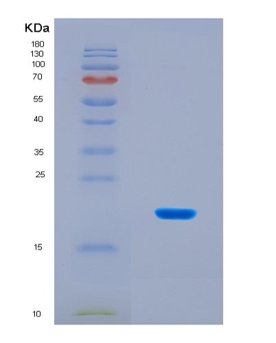 SDS-PAGE analysis of Human ADISSP (Adipose-Secreted Signaling Protein) - Recombinant Protein, CAT# BLT-08800P showing >90% purity under 15% SDS-PAGE (Reduced)