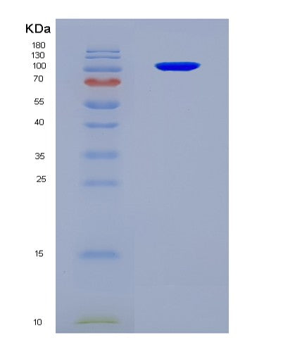 SDS-PAGE analysis of Human SEMA3A (Semaphorin-3A) - Recombinant Protein, CAT# BLT-08808P showing >90% purity under 15% SDS-PAGE (Reduced)