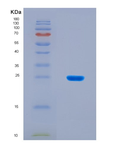 SDS-PAGE analysis of Human PTGIR (Prostacyclin Receptor) - Recombinant Protein, CAT# BLT-08870P showing >90% purity under 15% SDS-PAGE (Reduced)