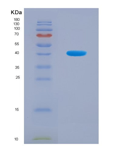 SDS-PAGE analysis of Human HEPH (Hephaestin) - Recombinant Protein, CAT# BLT-08899P showing >90% purity under 15% SDS-PAGE (Reduced)