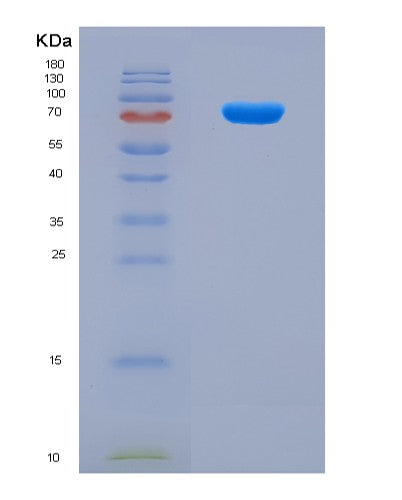SDS-PAGE analysis of Human NSUN2 (Rna Cytosine C(5)-Methyltransferase Nsun2) - Recombinant Protein, CAT# BLT-08912P showing >90% purity under 15% SDS-PAGE (Reduced)