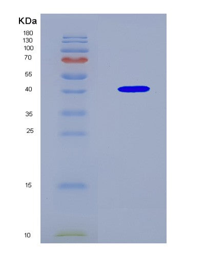 SDS-PAGE analysis of Mouse Rab27b (Ras-Related Protein Rab-27B) - Recombinant Protein, CAT# BLT-08934P showing >90% purity under 15% SDS-PAGE (Reduced)