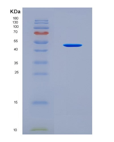 SDS-PAGE analysis of Human TFG (Protein Tfg) - Recombinant Protein, CAT# BLT-08941P showing >90% purity under 15% SDS-PAGE (Reduced)
