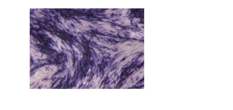 BCIP/NBT Solution for IHC