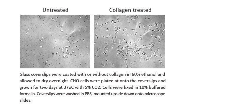 Collagenase Type I Solution 0.25% in PBS with 20% FBS, 20ml