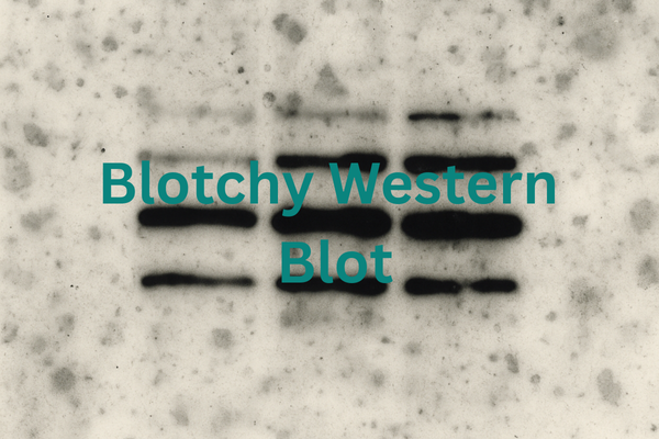 Blotchy Western Blot: Causes, Troubleshooting; Best Practices