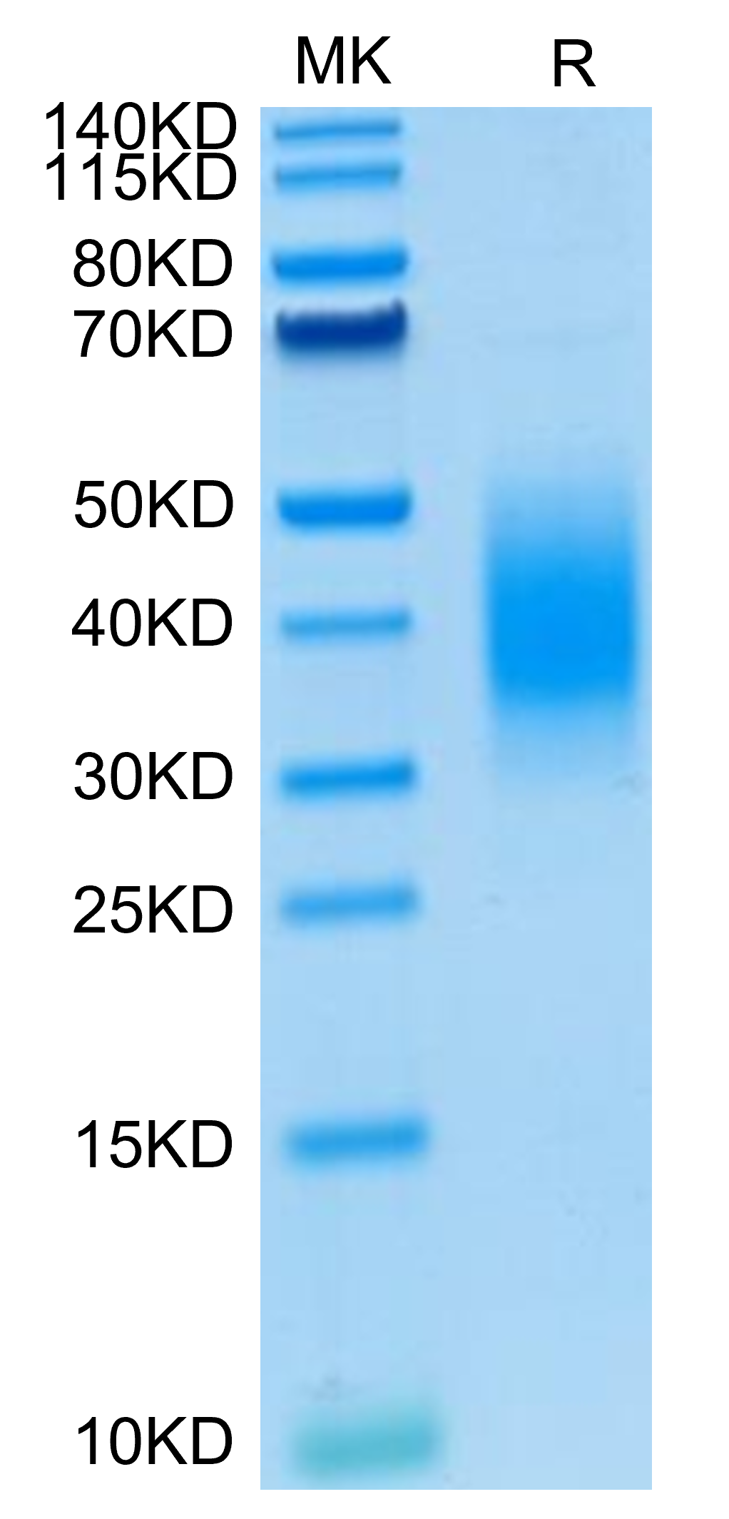 Mouse BTLA-on Tris-Bis PAGE under reduced condition. The purity is greater than 95%.