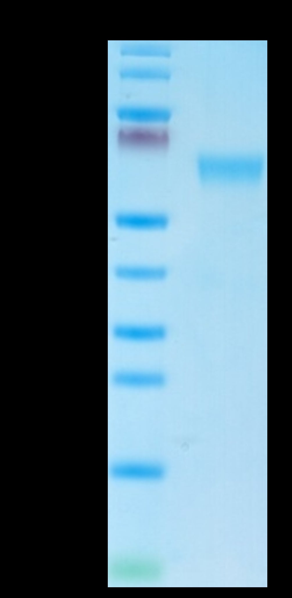 Mouse NKG2A&CD94 on Tris-Bis PAGE under reduced condition. The purity is greater than 95%.