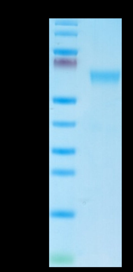 Mouse NKG2A&CD94 on Tris-Bis PAGE under reduced condition. The purity is greater than 95%.