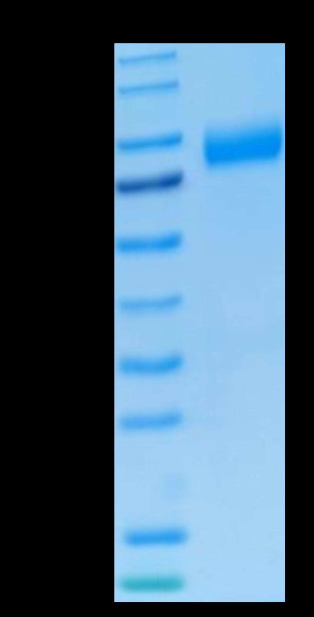 Human NKG2A&CD94 on Tris-Bis PAGE under reduced condition. The purity is greater than 95%.