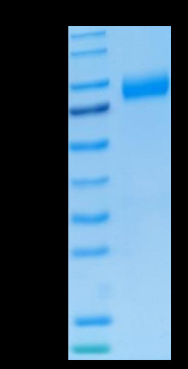 Human NKG2A&CD94 on Tris-Bis PAGE under reduced condition. The purity is greater than 95%.