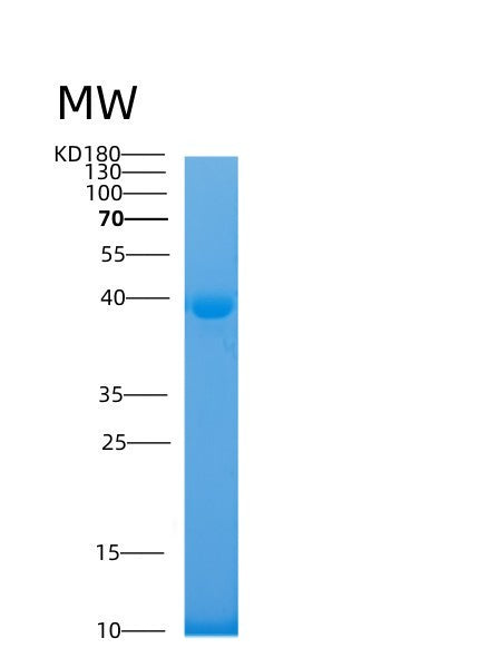 SDS-PAGE analysis of Human MAPT (Microtubule-Associated Protein Tau) - Recombinant Protein, showing >95% purity under 15% SDS-PAGE (Reduced)