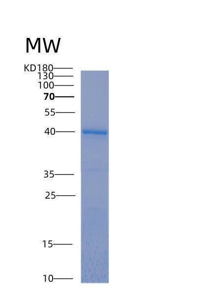 SDS-PAGE analysis of Human MAPT (Microtubule-Associated Protein Tau) - Recombinant Protein, showing >85% purity under 15% SDS-PAGE (Reduced)