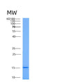 SDS-PAGE analysis of Human AAMDC (Mth938 Domain-Containing Protein) - Recombinant Protein, showing >90% purity under 15% SDS-PAGE (Reduced)