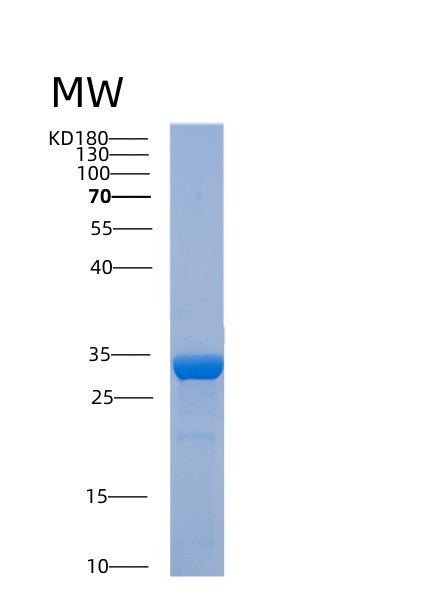SDS-PAGE analysis of Human ABHD10 (Palmitoyl-Protein Thioesterase Abhd10, Mitochondrial) - Recombinant Protein, showing >95% purity under 15% SDS-PAGE (Reduced)
