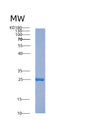 SDS-PAGE analysis of Human ABHD14B (Putative Protein-Lysine Deacylase Abhd14B) - Recombinant Protein, showing >85% purity under 15% SDS-PAGE (Reduced)