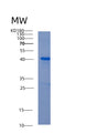 SDS-PAGE analysis of Human ABI3 (Abi Gene Family Member 3) - Recombinant Protein, showing >95% purity under 15% SDS-PAGE (Reduced)