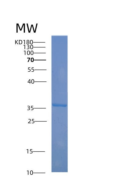 SDS-PAGE analysis of Human ABO (Histo-Blood Group Abo System Transferase) - Recombinant Protein, showing >90% purity under 15% SDS-PAGE (Reduced)