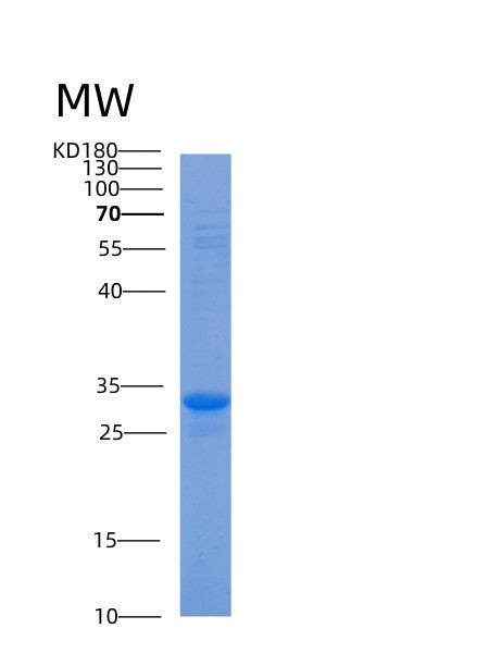 SDS-PAGE analysis of Human ACBD6 (Acyl-Coa-Binding Domain-Containing Protein 6) - Recombinant Protein, showing >90% purity under 15% SDS-PAGE (Reduced)